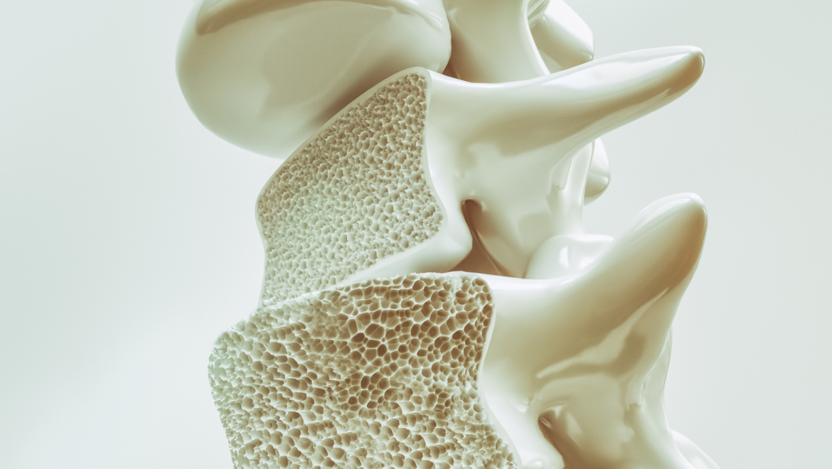 Magnetoterapia - Osteoporosi