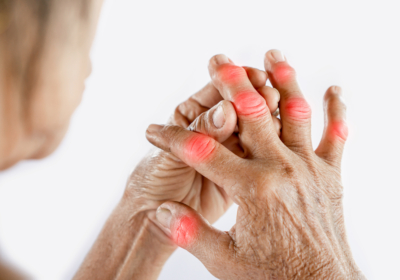 Come affrontare l'Artrite con la magnetoterapia domiciliare