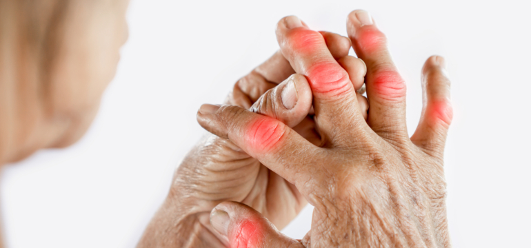 Come affrontare l'Artrite con la magnetoterapia domiciliare